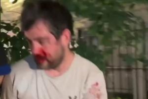 被打到退出刺籍！“鄧肯”慘遭紐約暴徒圍毆！血流滿面脫球衣保命