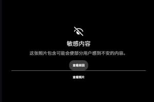露骨！慎入！范德彪小拇指的骨頭直接刺出來了！